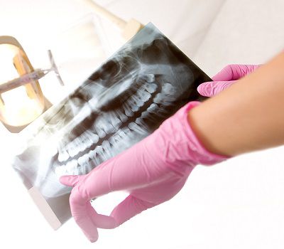 Digital X-Rays Digital X-Rays