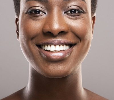 Teeth Whitening Teeth Whitening